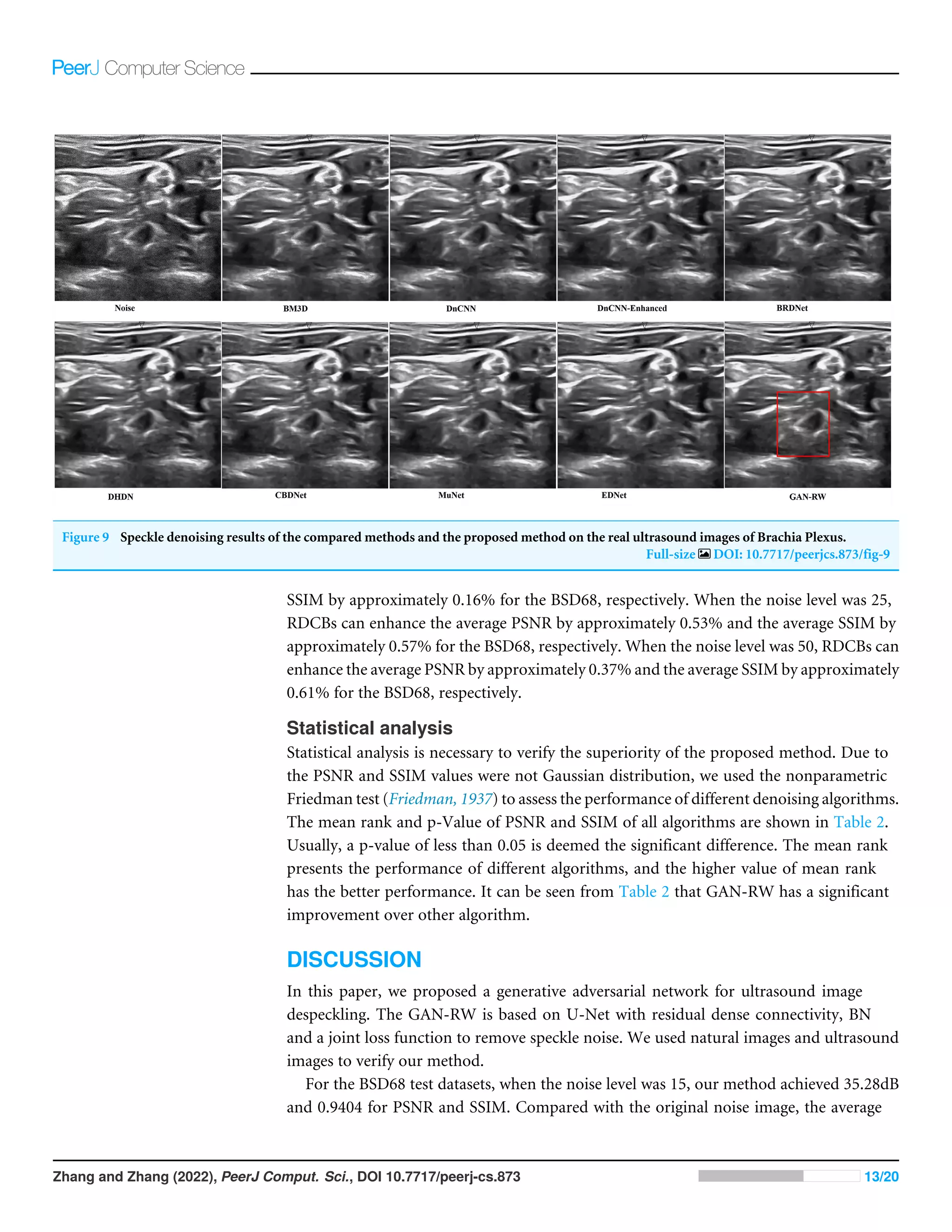 Figure 9 Speckle denoising results of the compared methods and the proposed method on the real ultrasound images of Brachia Plexus.
Full-size DOI: 10.7717/peerjcs.873/fig-9
SSIM by approximately 0.16% for the BSD68, respectively. When the noise level was 25,
RDCBs can enhance the average PSNR by approximately 0.53% and the average SSIM by
approximately 0.57% for the BSD68, respectively. When the noise level was 50, RDCBs can
enhance the average PSNR by approximately 0.37% and the average SSIM by approximately
0.61% for the BSD68, respectively.
Statistical analysis
Statistical analysis is necessary to verify the superiority of the proposed method. Due to
the PSNR and SSIM values were not Gaussian distribution, we used the nonparametric
Friedman test (Friedman, 1937) to assess the performance of different denoising algorithms.
The mean rank and p-Value of PSNR and SSIM of all algorithms are shown in Table 2.
Usually, a p-value of less than 0.05 is deemed the significant difference. The mean rank
presents the performance of different algorithms, and the higher value of mean rank
has the better performance. It can be seen from Table 2 that GAN-RW has a significant
improvement over other algorithm.
DISCUSSION
In this paper, we proposed a generative adversarial network for ultrasound image
despeckling. The GAN-RW is based on U-Net with residual dense connectivity, BN
and a joint loss function to remove speckle noise. We used natural images and ultrasound
images to verify our method.
For the BSD68 test datasets, when the noise level was 15, our method achieved 35.28dB
and 0.9404 for PSNR and SSIM. Compared with the original noise image, the average
Zhang and Zhang (2022), PeerJ Comput. Sci., DOI 10.7717/peerj-cs.873 13/20
 