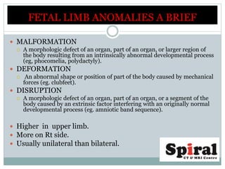 FETAL LIMB ANOMALIES A BRIEF
 MALFORMATION
 A morphologic defect of an organ, part of an organ, or larger region of
the body resulting from an intrinsically abnormal developmental process
(eg, phocomelia, polydactyly).
 DEFORMATION
 An abnormal shape or position of part of the body caused by mechanical
forces (eg. clubfeet).
 DISRUPTION
 A morphologic defect of an organ, part of an organ, or a segment of the
body caused by an extrinsic factor interfering with an originally normal
developmental process (eg. amniotic band sequence).
 Higher in upper limb.
 More on Rt side.
 Usually unilateral than bilateral.
 