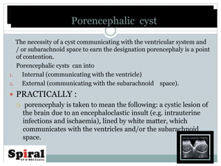 The necessity of a cyst communicating with the ventricular system and
/ or subarachnoid space to earn the designation porencephaly is a point
of contention.
Porencephalic cysts can into
1. Internal (communicating with the ventricle)
2. External (communicating with the subarachnoid space).
 PRACTICALLY :
 porencephaly is taken to mean the following: a cystic lesion of
the brain due to an encephaloclastic insult (e.g. intrauterine
infections and ischaemia), lined by white matter, which
communicates with the ventricles and/or the subarachnoid
space.
Porencephalic cystPorencephalic cyst
 