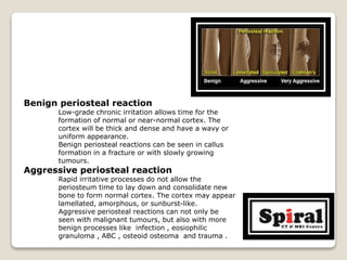 Benign periosteal reaction
Low-grade chronic irritation allows time for the
formation of normal or near-normal cortex. The
cortex will be thick and dense and have a wavy or
uniform appearance.
Benign periosteal reactions can be seen in callus
formation in a fracture or with slowly growing
tumours.
Aggressive periosteal reaction
Rapid irritative processes do not allow the
periosteum time to lay down and consolidate new
bone to form normal cortex. The cortex may appear
lamellated, amorphous, or sunburst-like.
Aggressive periosteal reactions can not only be
seen with malignant tumours, but also with more
benign processes like infection , eosiophilic
granuloma , ABC , osteoid osteoma and trauma .
 