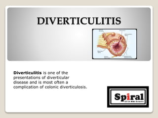 DIVERTICULITIS
Diverticulitis is one of the
presentations of diverticular
disease and is most often a
complication of colonic diverticulosis.
 
