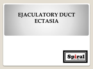 EJACULATORY DUCT
ECTASIA
 
