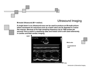 Ultrasound Imaging
M-mode Ultrasound (M = motion)
A single beam in an ultrasound scan can be used to produce an M-mode picture
where movement of a structure such as a heart valve can be depicted in a wave-
like manner. Because of its high sampling frequency (up to 1000 pulses per
second) This is useful in assessing rates and motion and is still used extensively
in cardiac and fetal cardiac imaging.
            depth




                                                                 Mitral valve

                                                                     LV (parasternal
                                                                     view




                                                              time

                                                                     Introduction to Biomedical Imaging
 