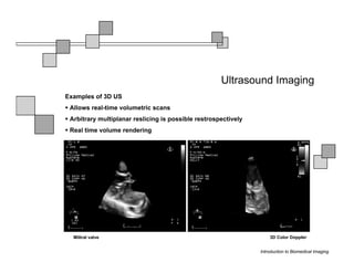 Ultrasound Imaging
Examples of 3D US
 Allows real-time volumetric scans
 Arbitrary multiplanar reslicing is possible restrospectively
 Real time volume rendering




  Miltral valve                                                     3D Color Doppler


                                                                Introduction to Biomedical Imaging
 