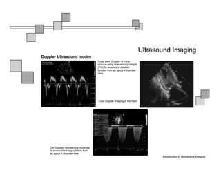Ultrasound Imaging
Doppler Ultrasound modes
                                          Pulse wave Doppler of mitral
                                          annulus using time-velocity integral
                                          (TVI) for analysis of diastolic
                                          function from an apical 4 chamber
                                          view.




                                          Color Doppler imaging of the heart




    CW Doppler representing moderate
    to severe mitral regurgitation from
    an apical 4 chamber view.
                                                                                        Introduction to Biomedical Imaging
 