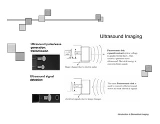 Ultrasound Imaging
Ultrasound pulse/wave
generation:
transmission




Ultrasound signal
detection




                               Introduction to Biomedical Imaging
 