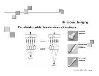 Ultrasound Imaging
Piezoelectric crystals, beam forming and transducers
                                                           Abdominal
                                                           Obstetrics




                                                          Intraoperative
                                                          vascular
                                                          (superficial)




                                                           Gynecology
                                                           Obstetrics




                                                 Introduction to Biomedical Imaging
 