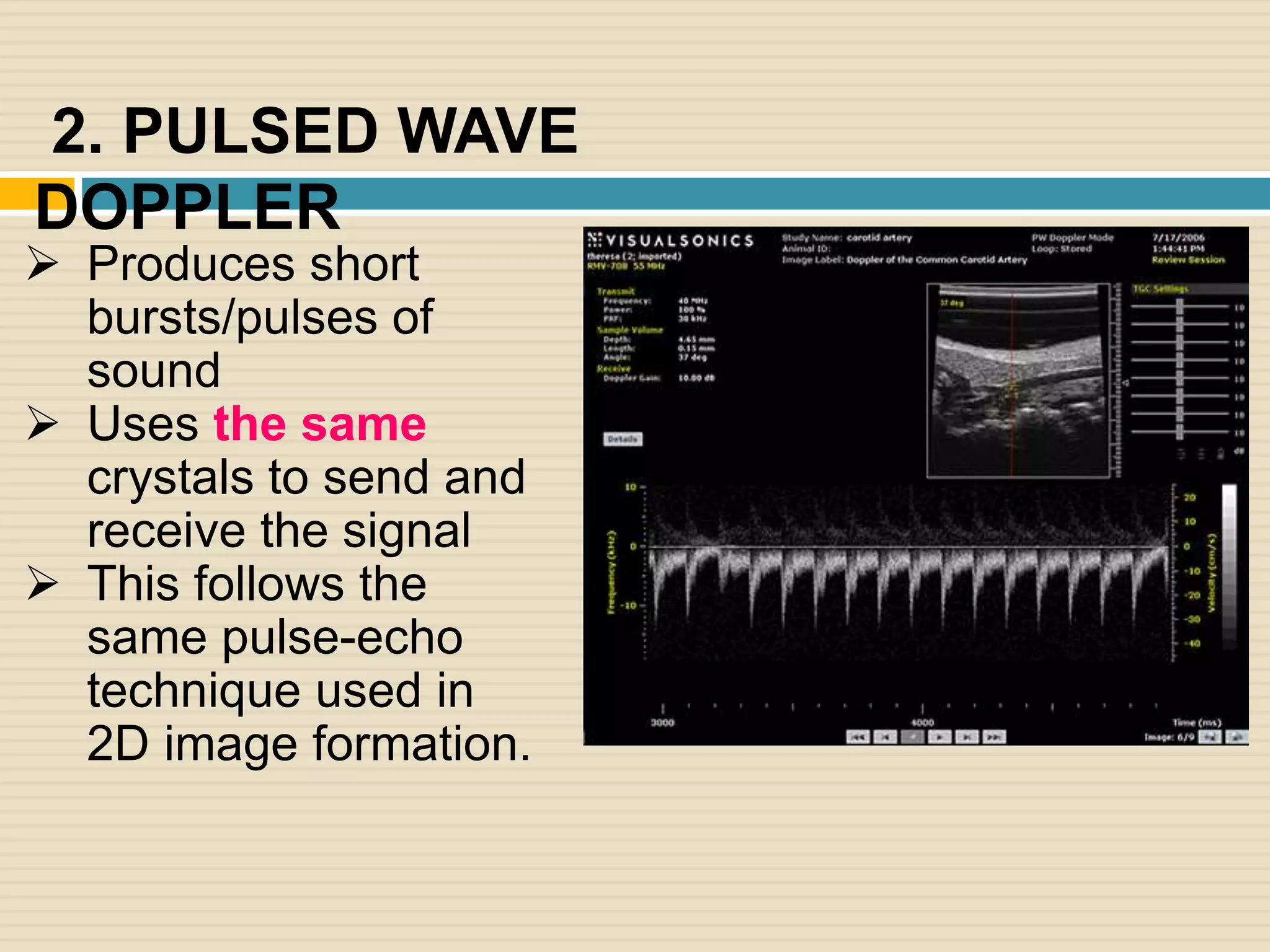 Ultrasound imaging | PPTX
