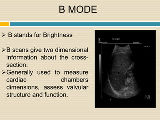 Ultrasound imaging