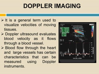 DOPPLER IMAGING
 It is a general term used to
visualize velocities of moving
tissues.
 Doppler ultrasound evaluates
bloo...