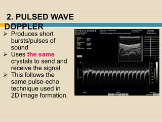 2. PULSED WAVE
DOPPLER
 Produces short
bursts/pulses of
sound
 Uses the same
crystals to send and
receive the signal
 T...