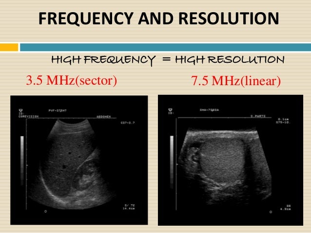 Ultrasound Imaging