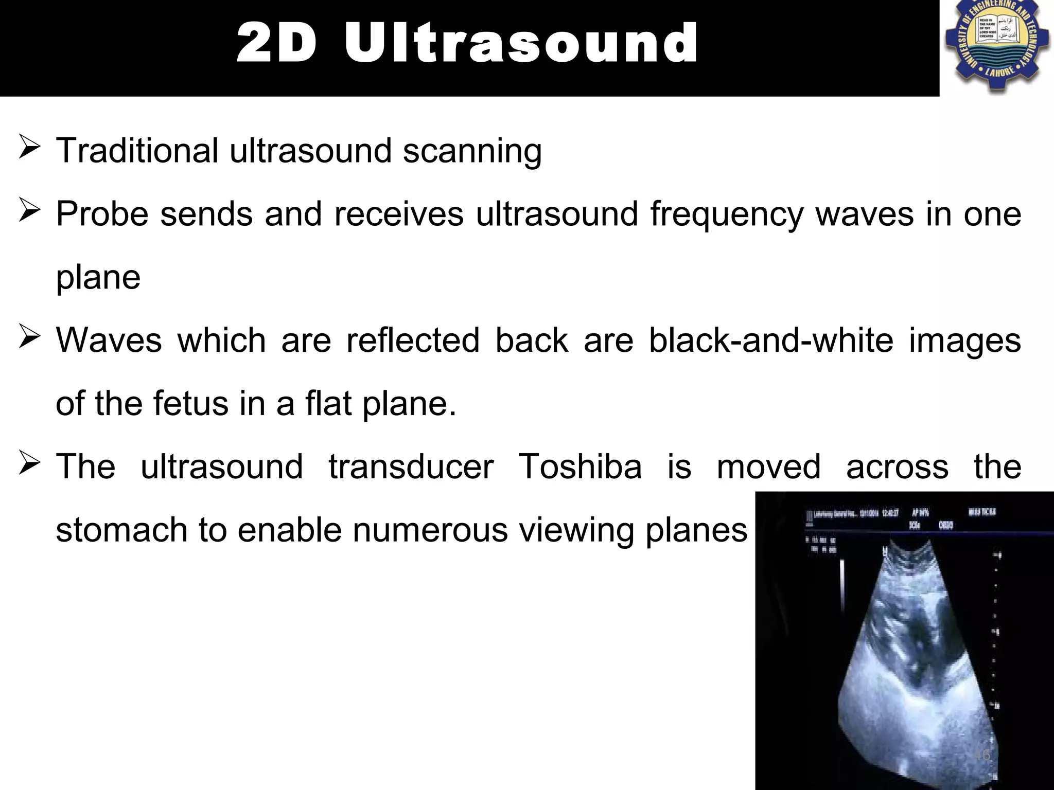 Ultrasound imaging | PPT