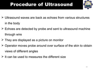  Ultrasound waves are back as echoes from various structures
in the body
 Echoes are detected by probe and sent to ultra...