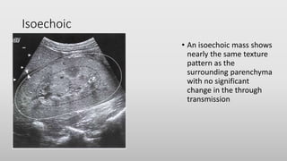 Ultrasound imaging | PPTX