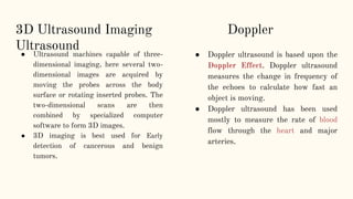 ULTRASOUND IMAGING.pptx