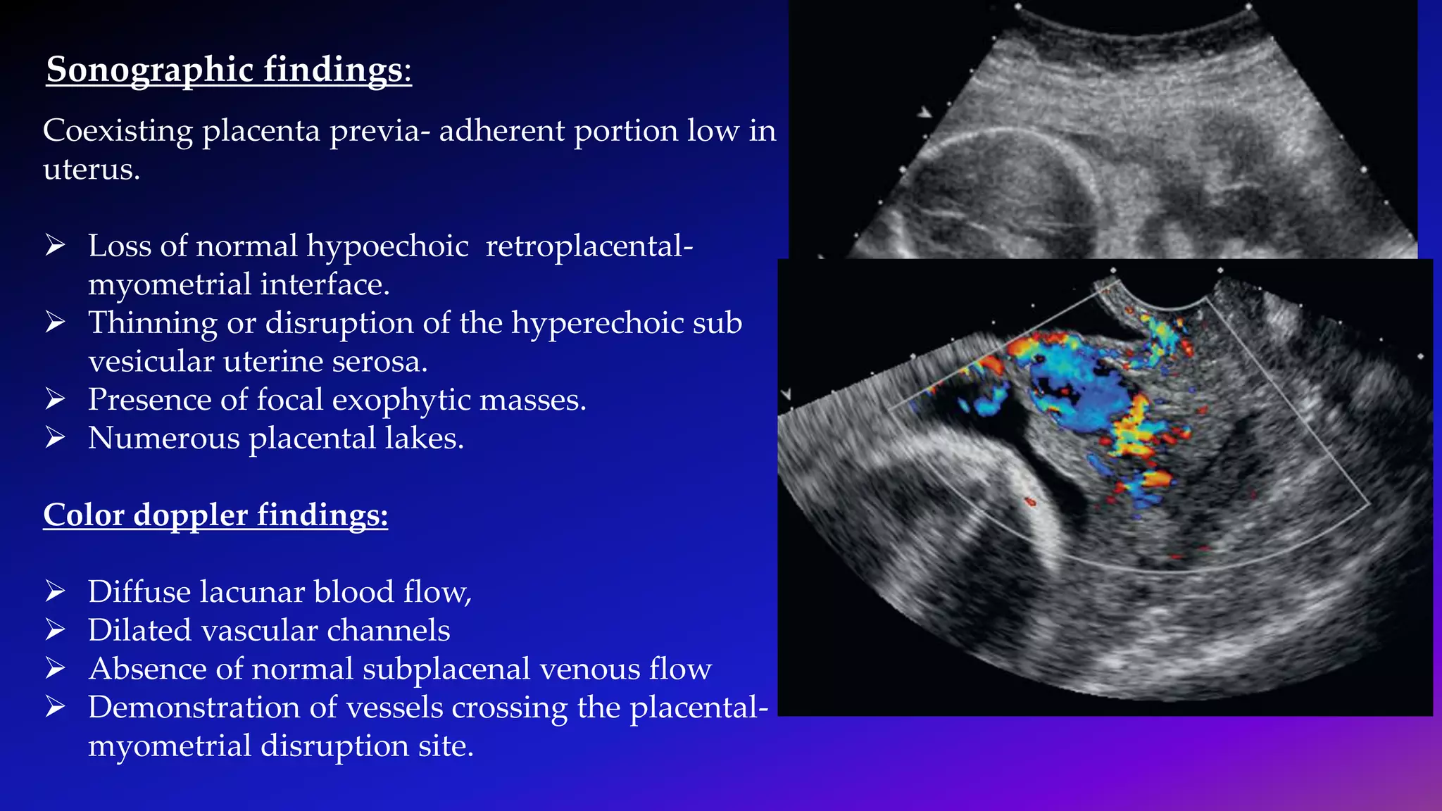 Ultrasound Imaging Of Placenta PPTX