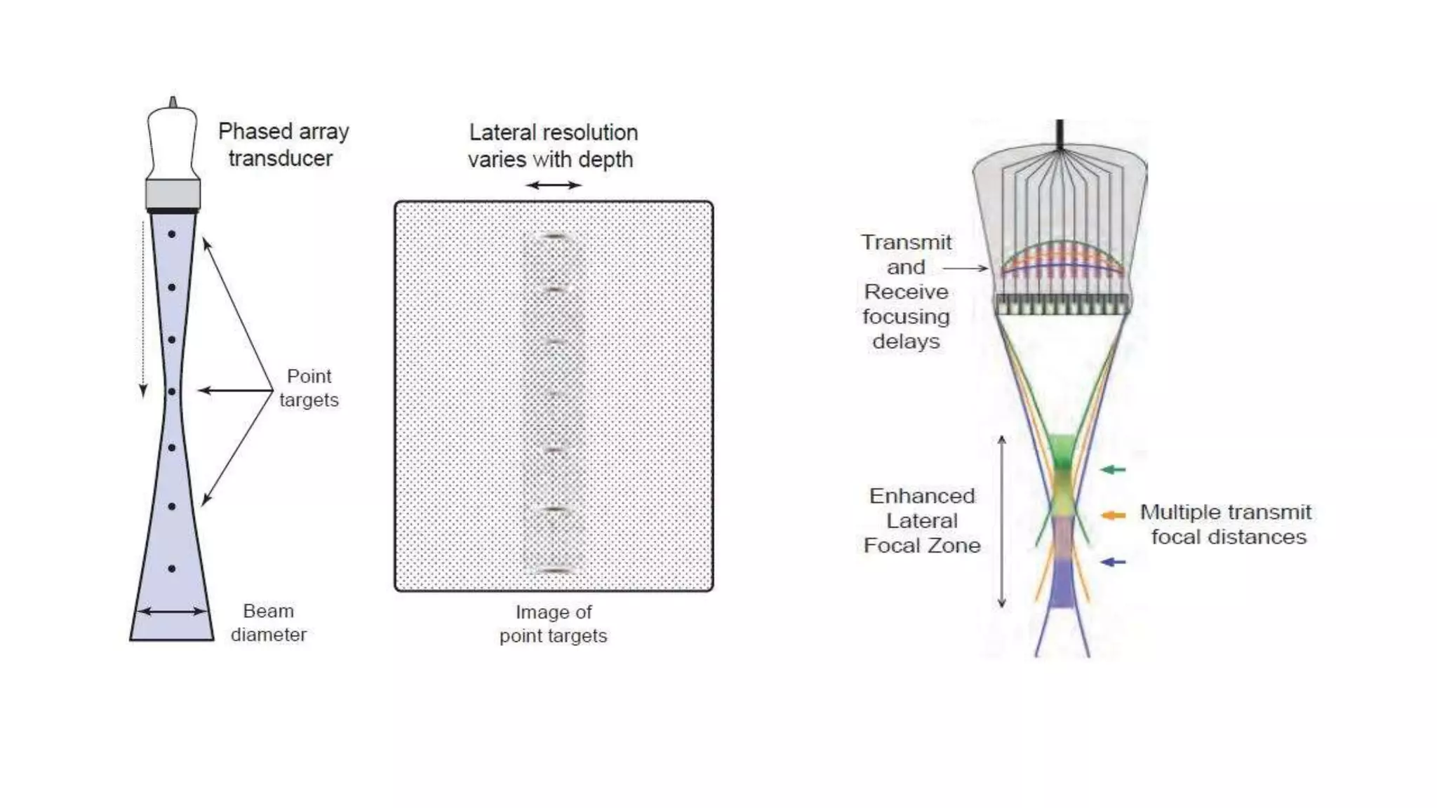 Ultrasound imaging system | PPTX