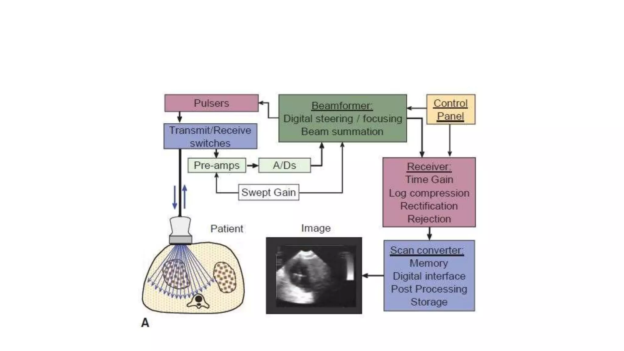 Ultrasound imaging system | PPTX