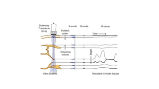 Ultrasound imaging system 