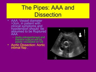 Ultrasound in critically ill patients | PPT