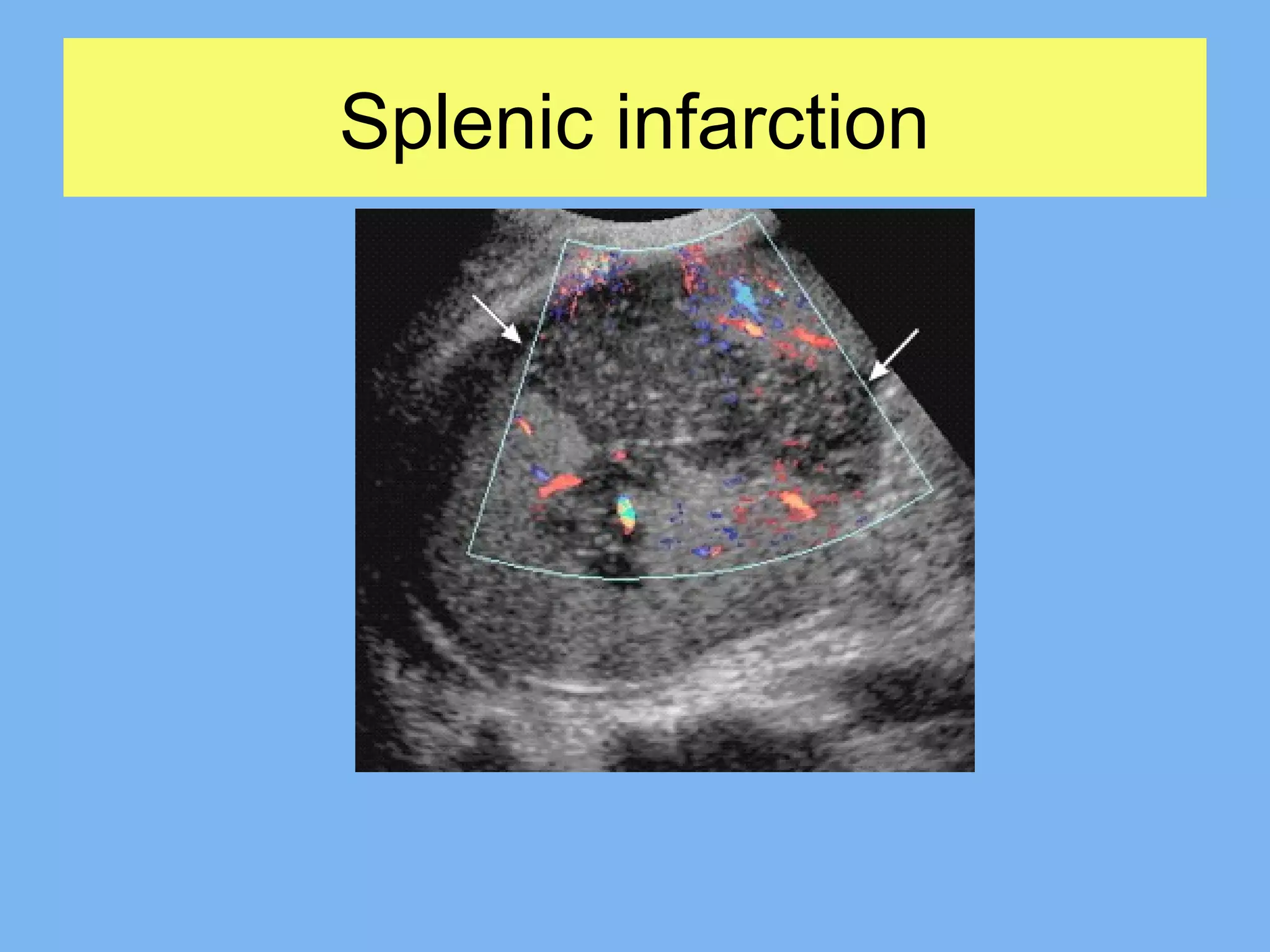 Ultrasound in abdominal emergencies | PPT