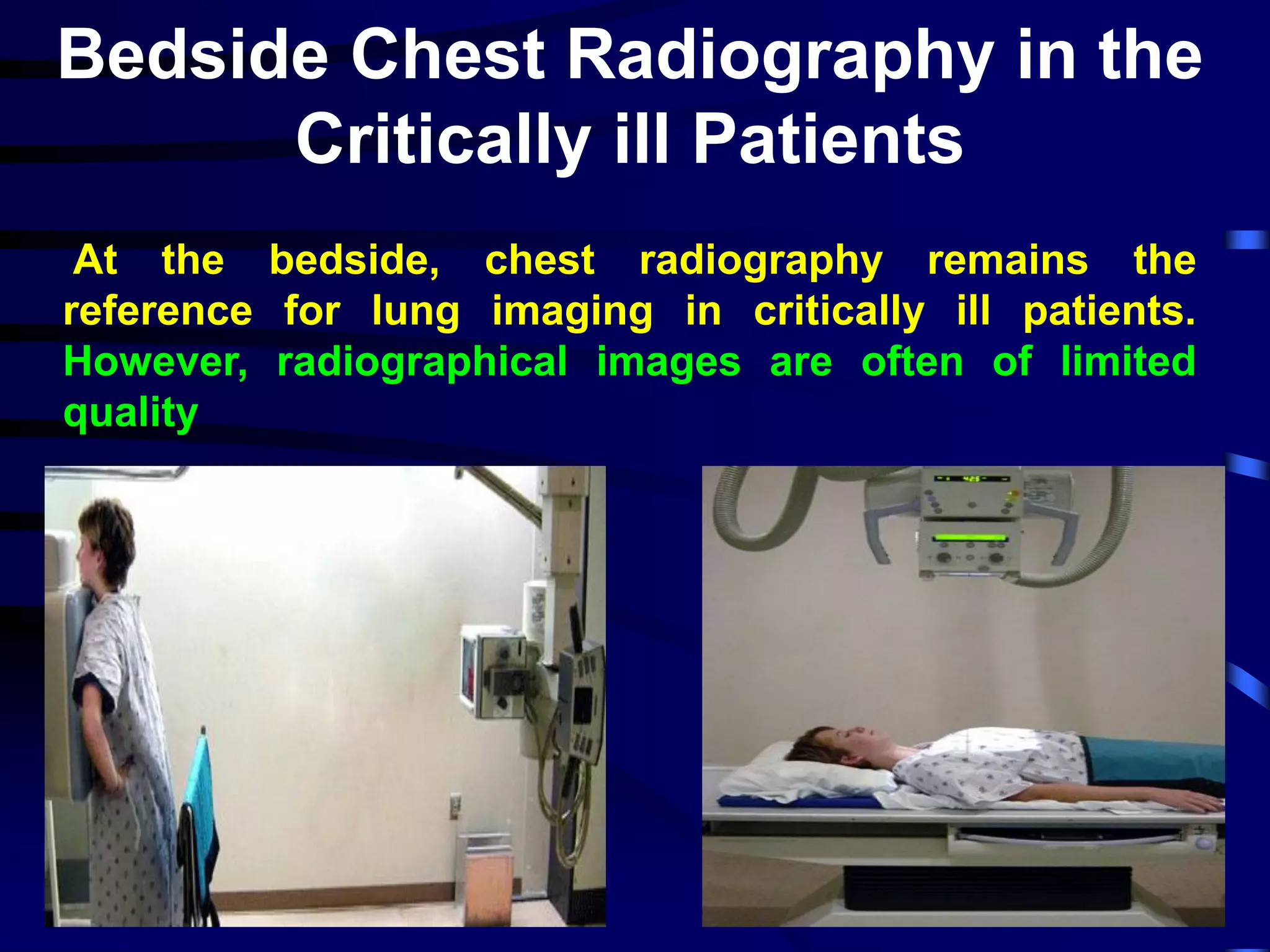 Ultrasound in ICU and Emergency | PDF