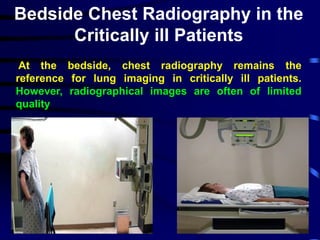 Ultrasound in ICU and Emergency | PDF