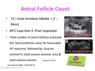Ultrasound in infertility | PPTX
