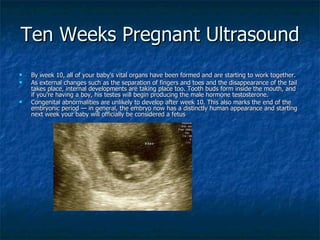 Ten Weeks Pregnant Ultrasound  <ul><li>By week 10, all of your baby's vital organs have been formed and are starting to wo...
