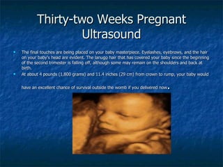 Thirty-two Weeks Pregnant Ultrasound <ul><li>The final touches are being placed on your baby masterpiece. Eyelashes, eyebr...