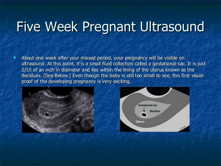 five week pregnant ult...