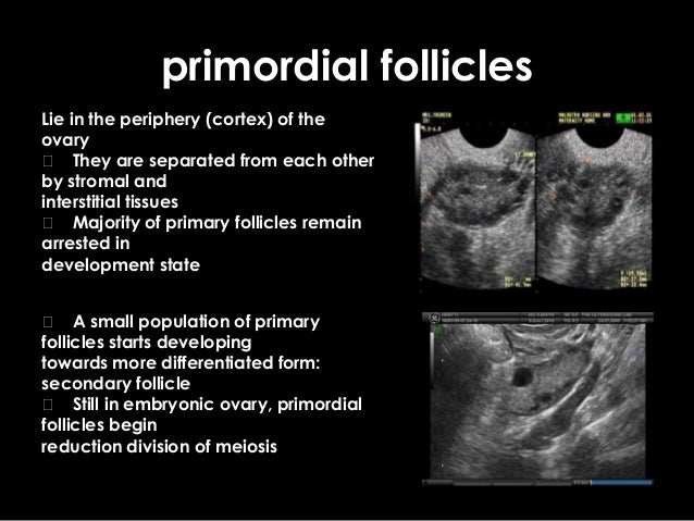 Ultrasound in reproductive endocrionology