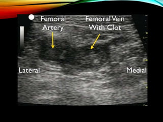 Ultrasound in Shock | PPTX