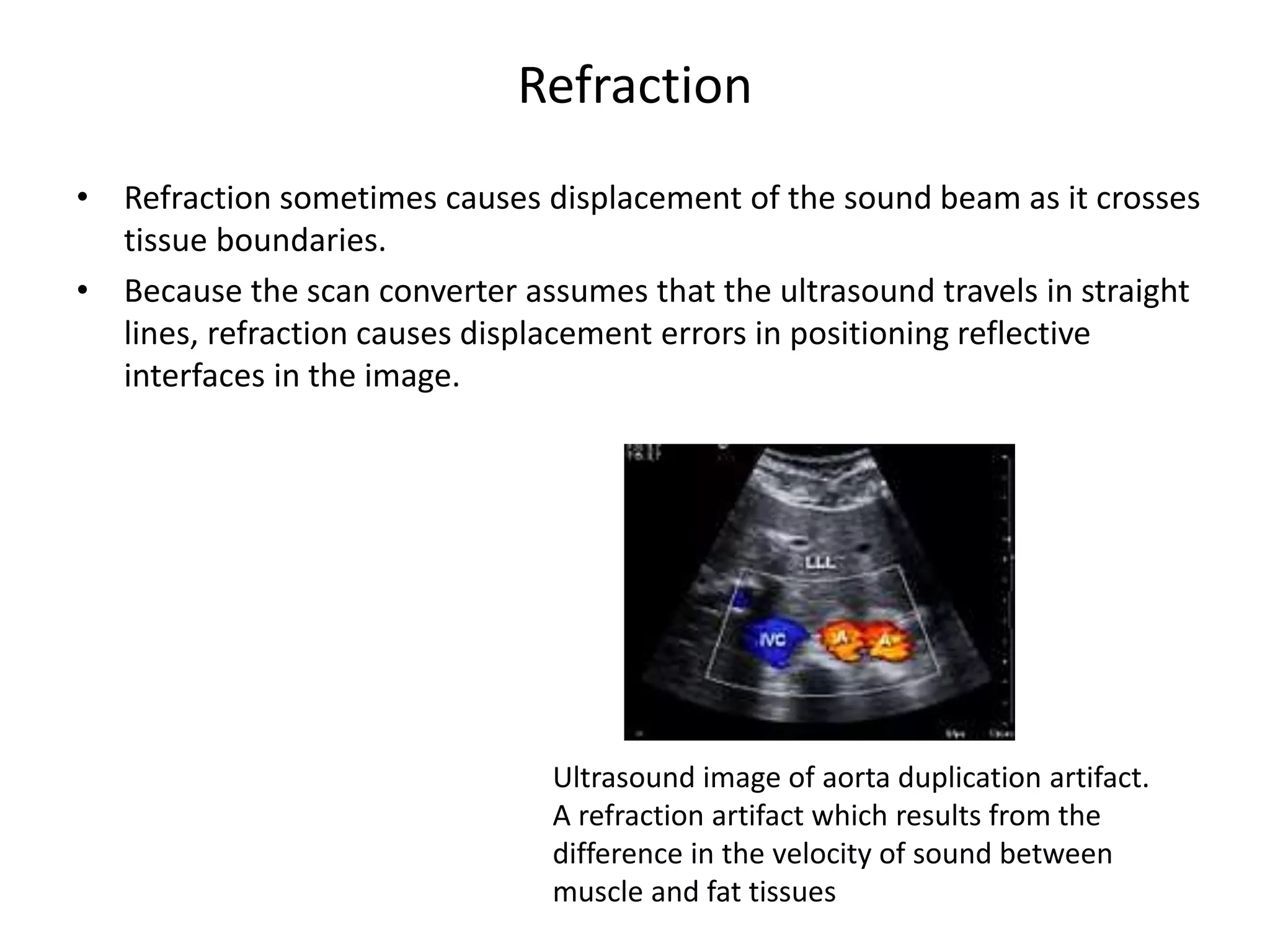 Ultrasound instrumentation | PPTX