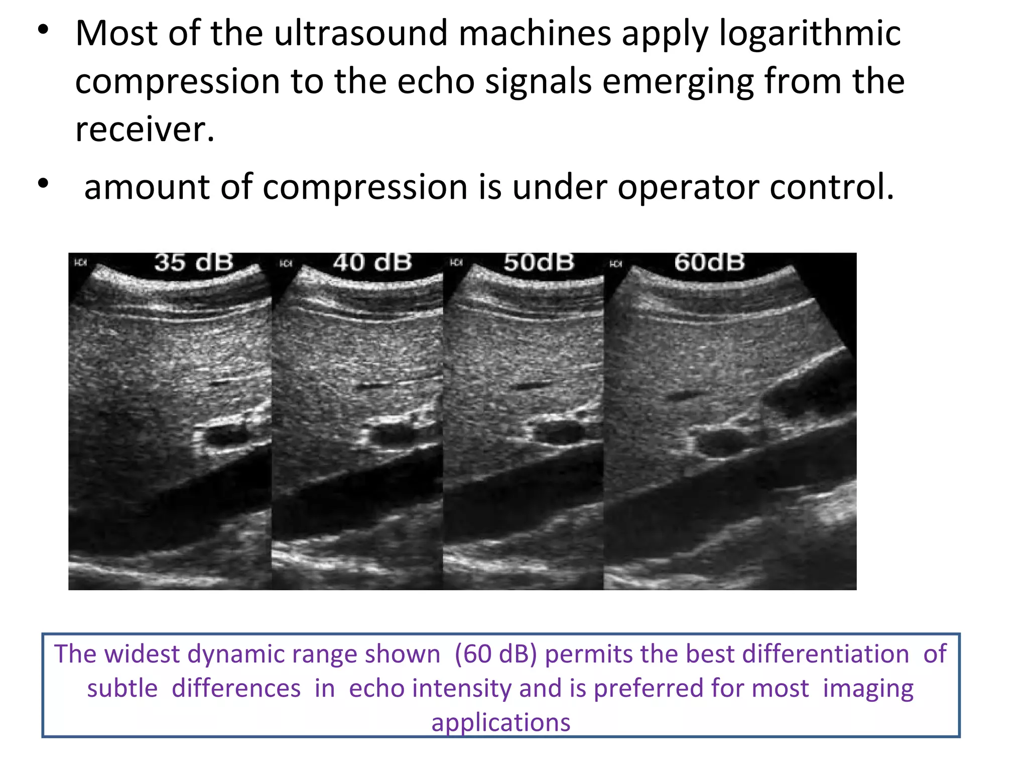 • Most of the ultrasound machines apply logarithmic
compression to the echo signals emerging from the
receiver.
• amount of compression is under operator control.
The widest dynamic range shown (60 dB) permits the best differentiation of
subtle differences in echo intensity and is preferred for most imaging
applications
 