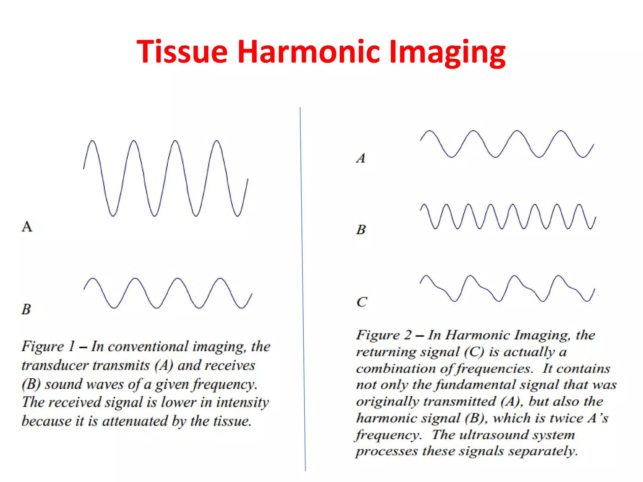 Tissue Harmonic Imaging
 