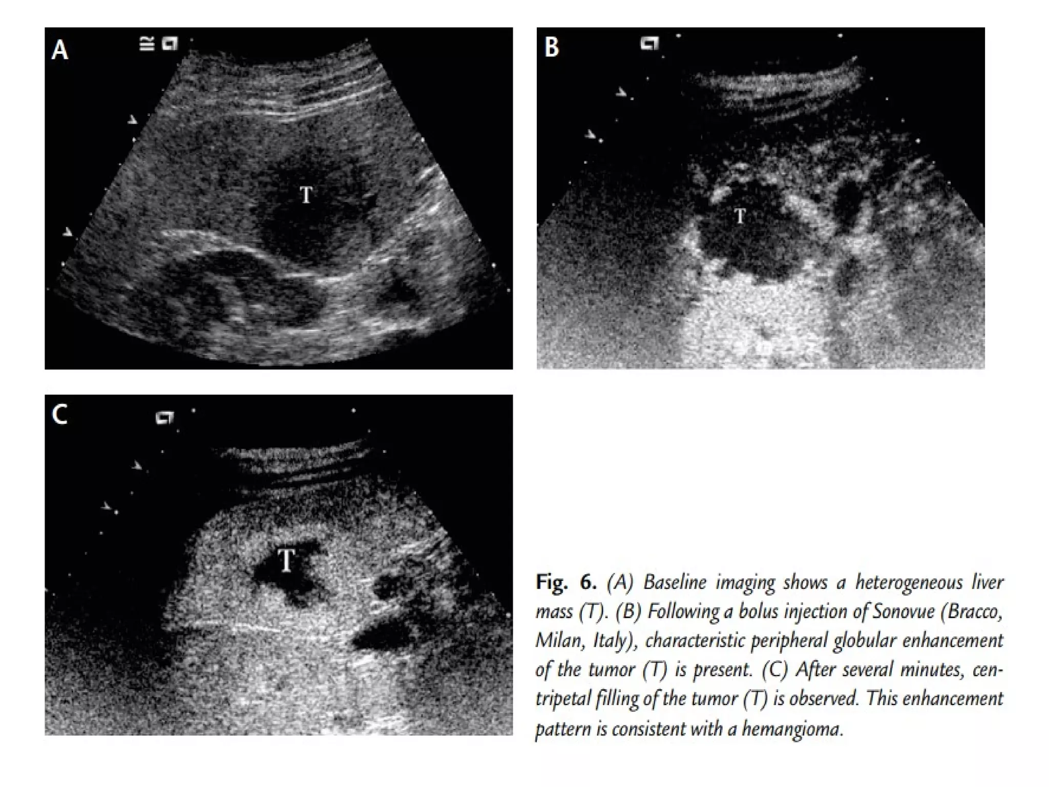 Ultrasound instrumentation practical applications