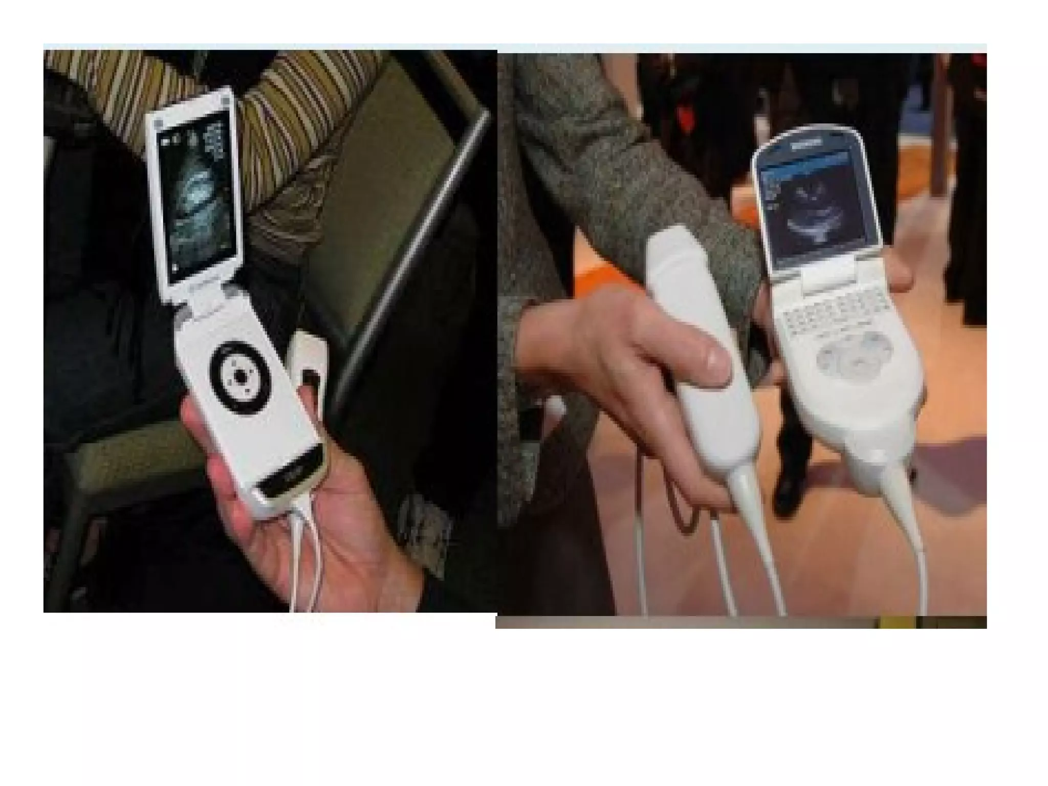 Ultrasound instrumentation practical applications