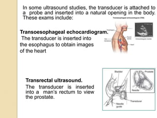 In some ultrasound studies, the transducer is attached to
a probe and inserted into a natural opening in the body.
These exams include:
Transrectal ultrasound.
The transducer is inserted
into a man’s rectum to view
the prostate.
Transoesophageal echocardiogram.
The transducer is inserted into
the esophagus to obtain images
of the heart
 