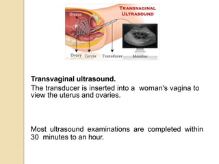Transvaginal ultrasound.
The transducer is inserted into a woman's vagina to
view the uterus and ovaries.
Most ultrasound examinations are completed within
30 minutes to an hour.
 