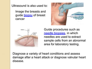 Ultrasound is also used to:
Guide procedures such as
needle biopsies, in which
needles are used to extract
sample cells from an abnormal
area for laboratory testing.
Diagnose a variety of heart conditions and assess
damage after a heart attack or diagnose valvular heart
disease.
Image the breasts and
guide biopsy of breast
cancer
 