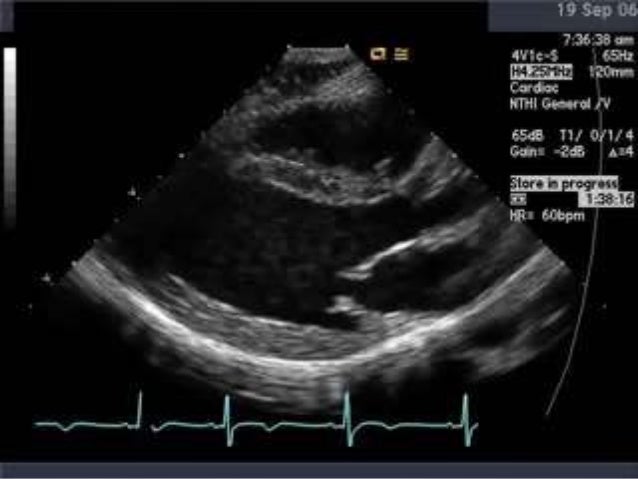 the evolving role of echocardiography in sepsis
