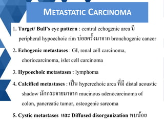1. Target/ Bull’s eye pattern : central echogenic area มี
peripheral hypoechoic rim บ่อยครั้งมาจาก bronchogenic cancer
2. ...