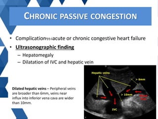 • Complicationของacute or chronic congestive heart failure
• Ultrasonographic finding
– Hepatomegaly
– Dilatation of IVC a...