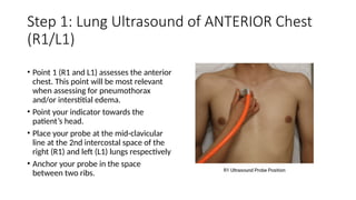 R1 Rib ULTRASOUND LUNG , A short review in POCUS on lung.pptx