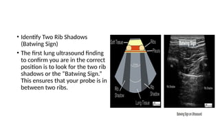 Batwing Sign Fast ULTRASOUND LUNG , A short review in POCUS on lung.pptx