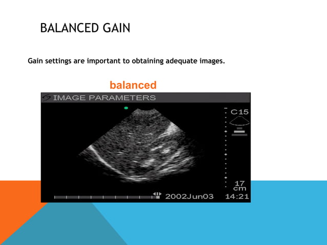 Ultrasound machine | PPT