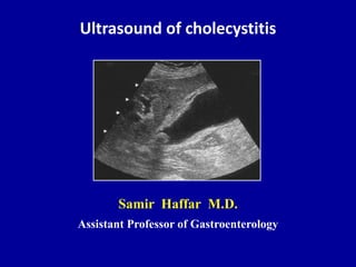 Ultrasound of cholecystitis
Samir Haffar M.D.
Assistant Professor of Gastroenterology
 