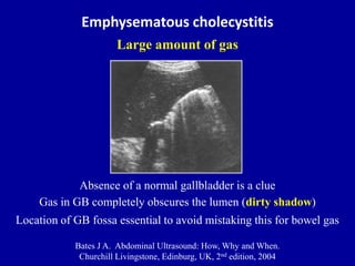 Emphysematous cholecystitis
Large amount of gas
Absence of a normal gallbladder is a clue
Gas in GB completely obscures th...